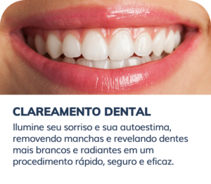 clareamento dental